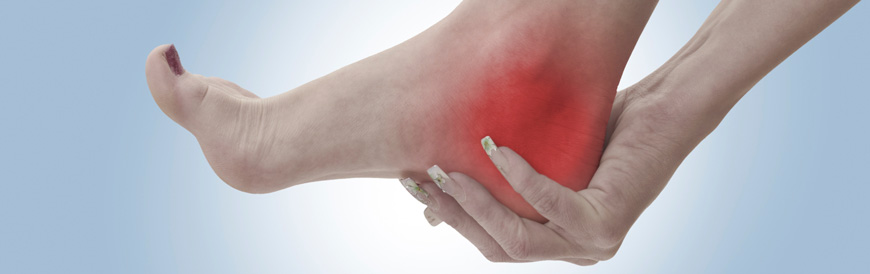 Plantar Fasciitis Chiropractors in San Leandro