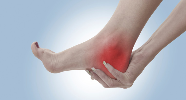 San Leandro Plantar Fasciitis Chiropractor